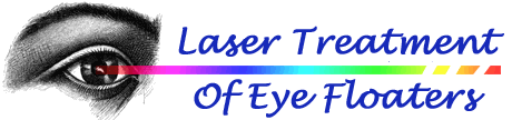 Laser Treatment of Eye Floaters