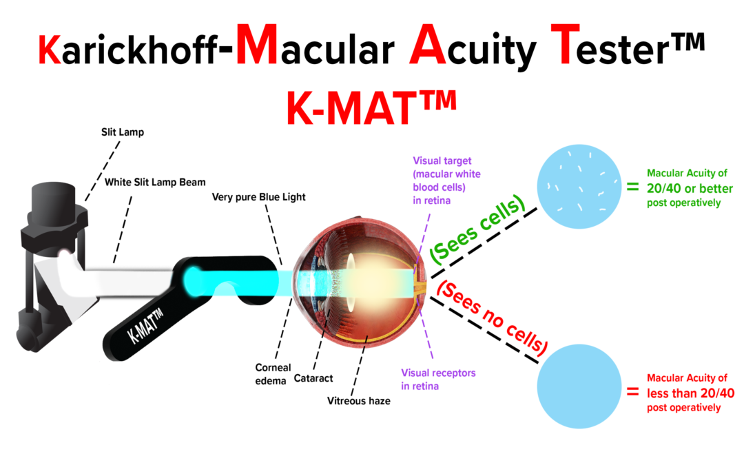 Karickhoff Macular Acuity Tester – K – Mat